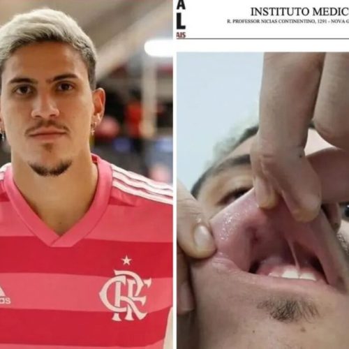 Pedro Guilherme: Saiba tudo sobre a agressão ao atacante do Flamengo