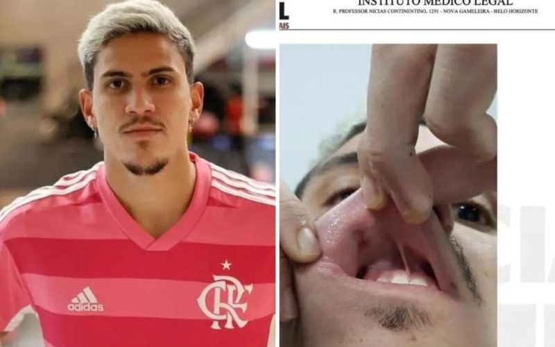 Pedro Guilherme: Saiba tudo sobre a agressão ao atacante do Flamengo