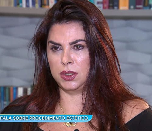 Mortes e intestino perfurado: veja outras acusações contra médica que fez lipo em advogada de MC Poze